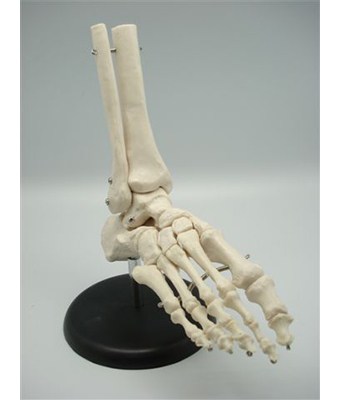 Foot Joint - Tredan Connections