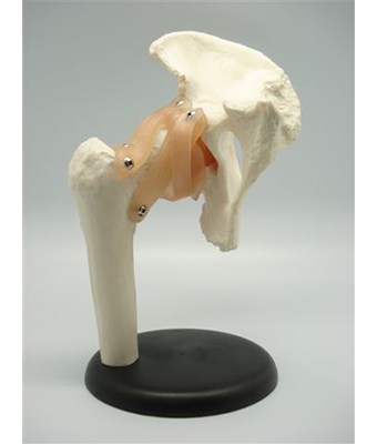 Hip Joint - Tredan Connections
